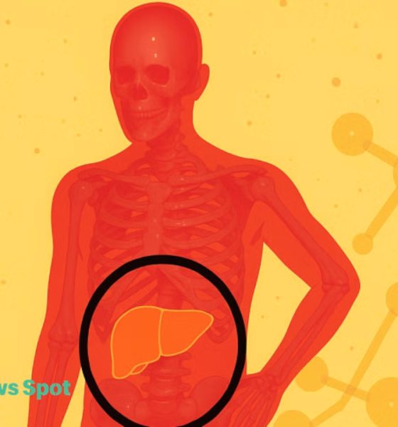 fatty liver