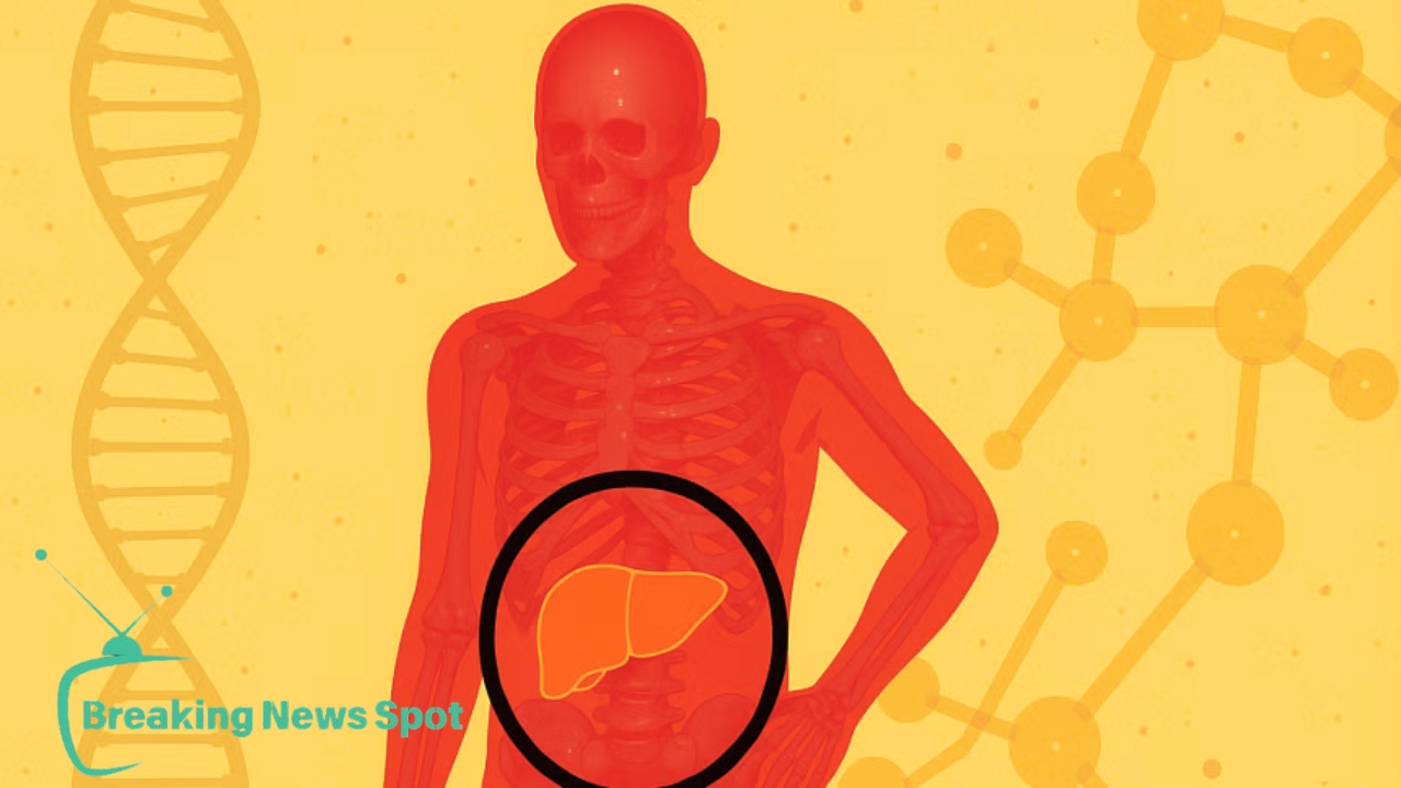 fatty liver